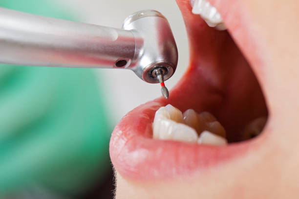 Best Emergency Dental Extractions in Pleasant Valley, WV